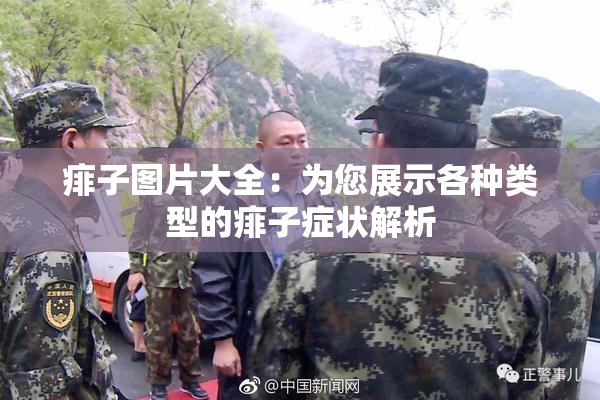 痱子图片大全：为您展示各种类型的痱子症状解析