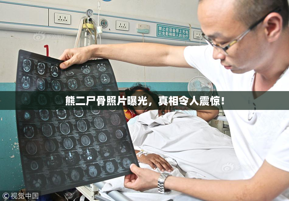 熊二尸骨照片曝光，真相令人震惊！
