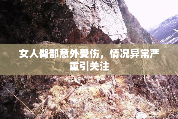 女人臀部意外受伤，情况异常严重引关注