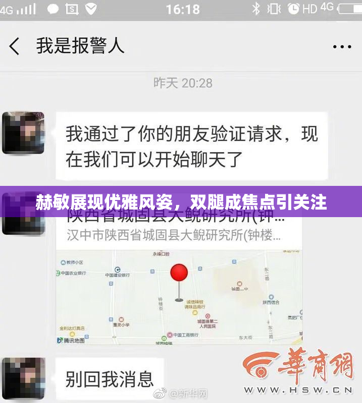 赫敏展现优雅风姿，双腿成焦点引关注