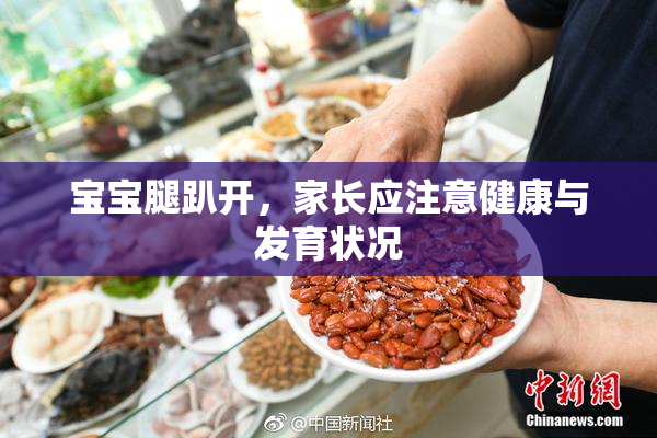 宝宝腿趴开，家长应注意健康与发育状况