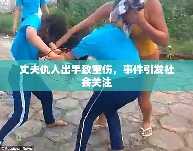 丈夫仇人出手致重伤，事件引发社会关注