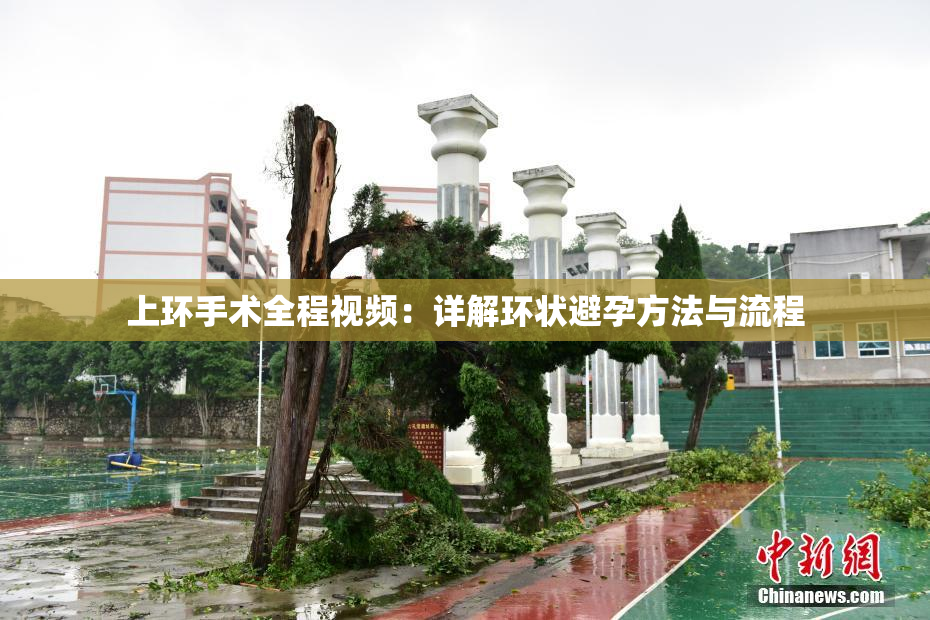 上环手术全程视频：详解环状避孕方法与流程