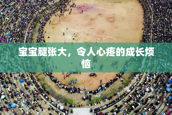 宝宝腿张大，令人心疼的成长烦恼