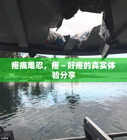疼痛难忍，疼～好疼的真实体验分享