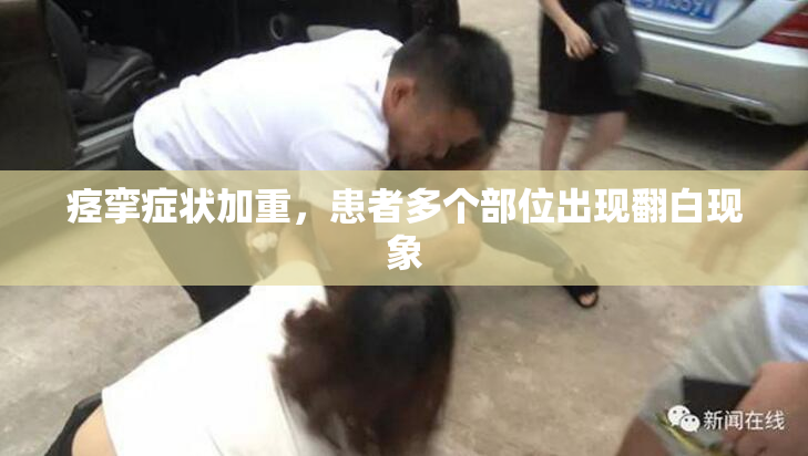 痉挛症状加重，患者多个部位出现翻白现象